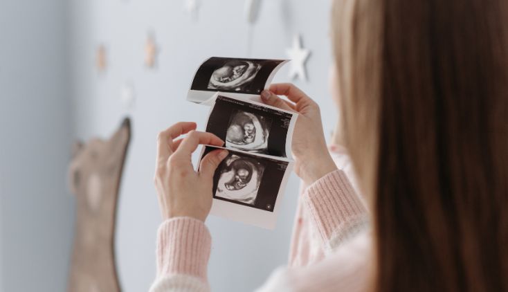 A woman holding up images of a pregnancy ultrasound.